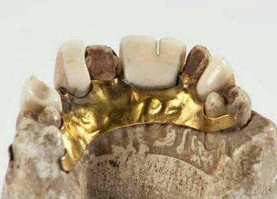 دندان مصنوعی طلایی 2700 ساله ای که آخرین صاحب آن یک پادشاه بود!
